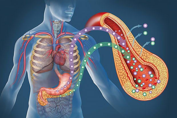 Understanding Type 2 Diabetes